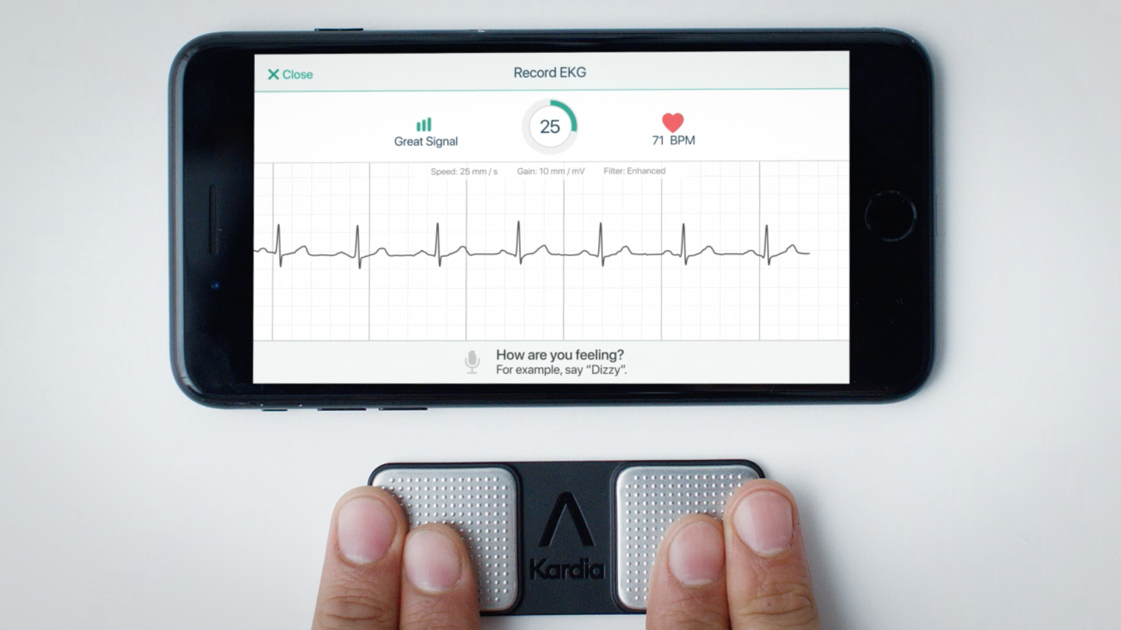 Das bringt das EKG der Apple Watch und anderer MedizinApps